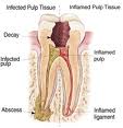 wp01c7e5ce Tooth diagram