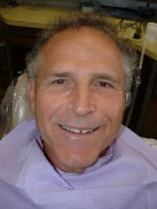 Before treatment, case 8