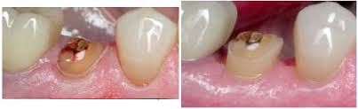wp51d13c69