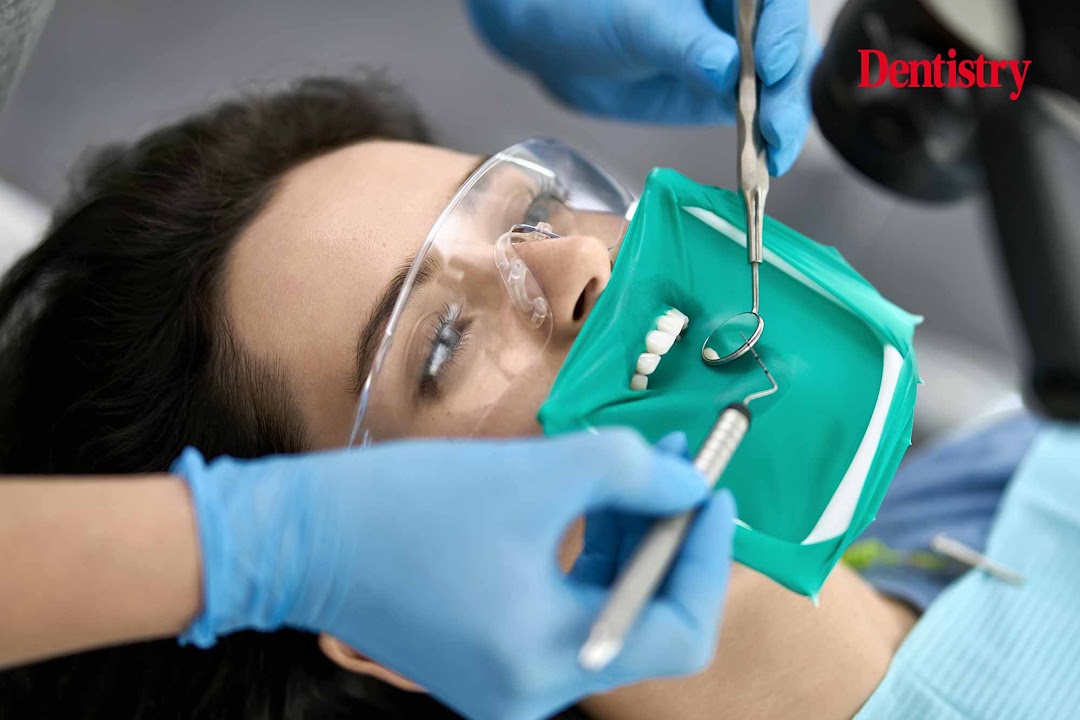 Rubber Dam Patient receiving root canal treatment with a green rubber dam isolating the tooth