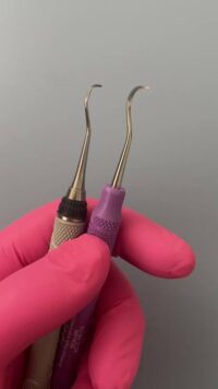 Two curved hand-scaling instruments used to remove tartar from teeth